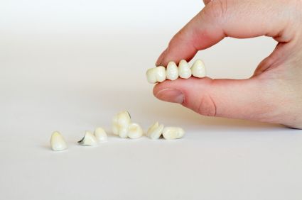 dental crowns