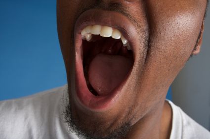 Oral Cancer Screening