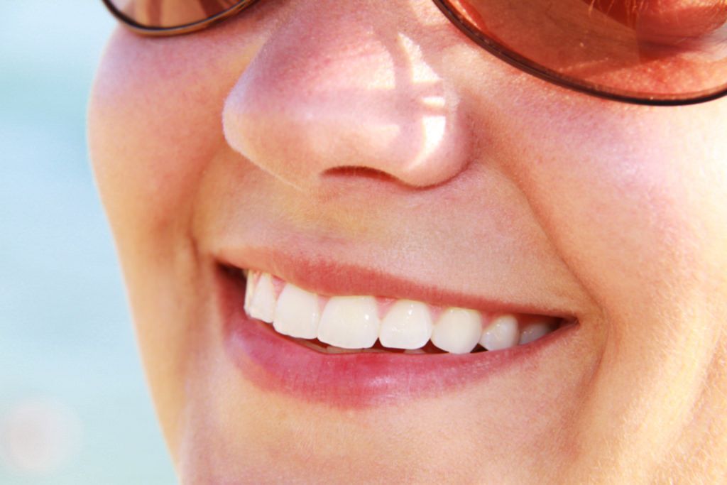 full mouth reconstruction vero beach