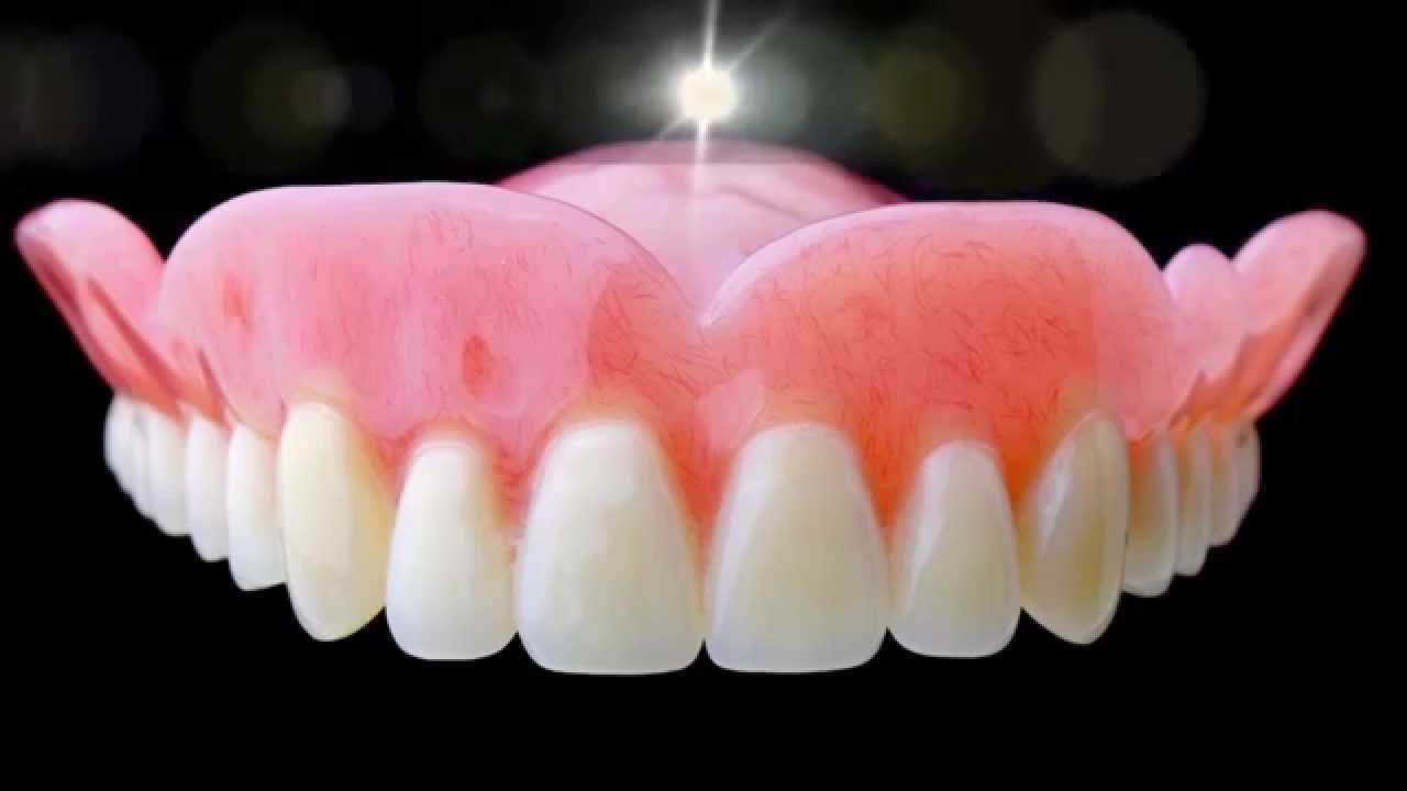 Types of Dentures