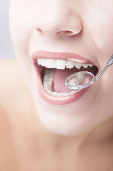 woman having a dental checkup