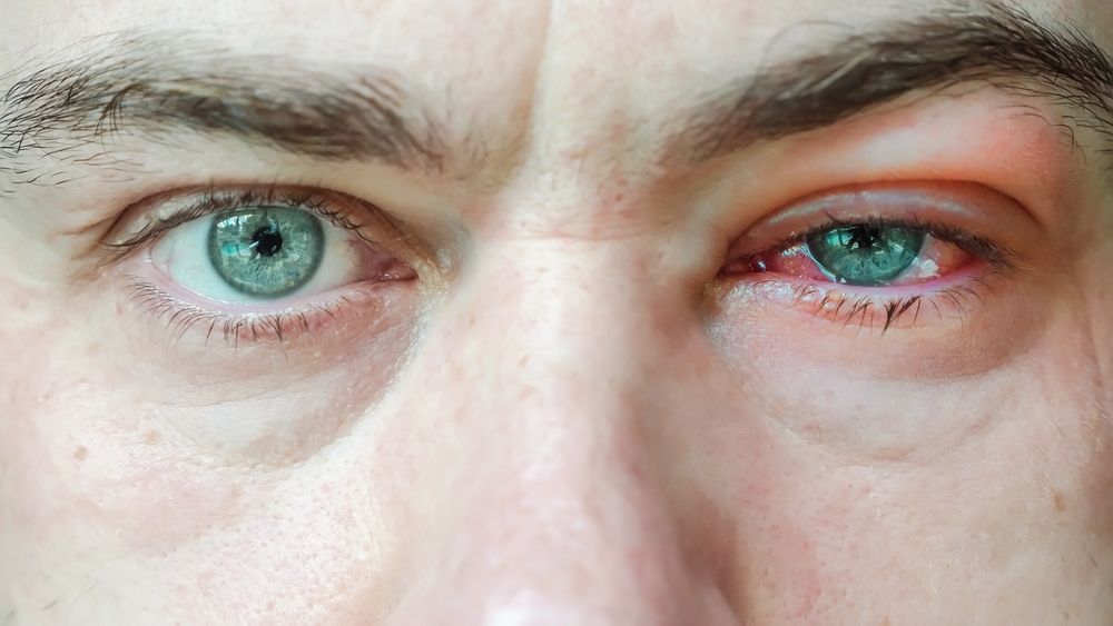 The Most Common Eye Injuries and How to Prevent Them