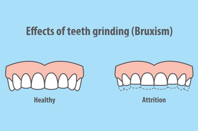 do you lose your canine teeth