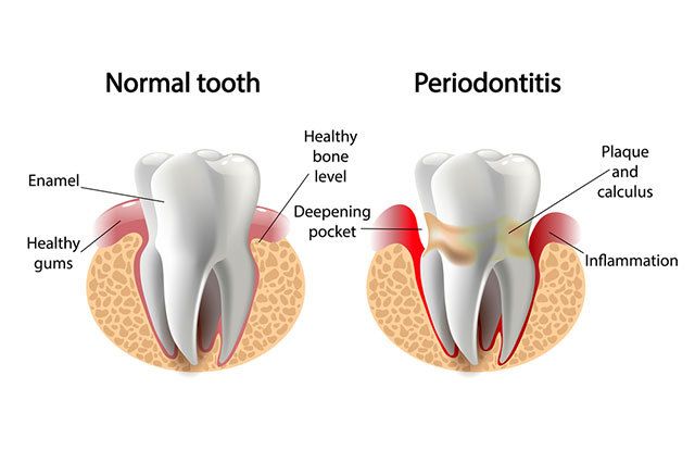 periodontics in Oakton VA