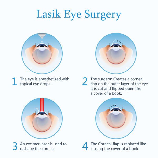 LASIK And Refractive Surgery