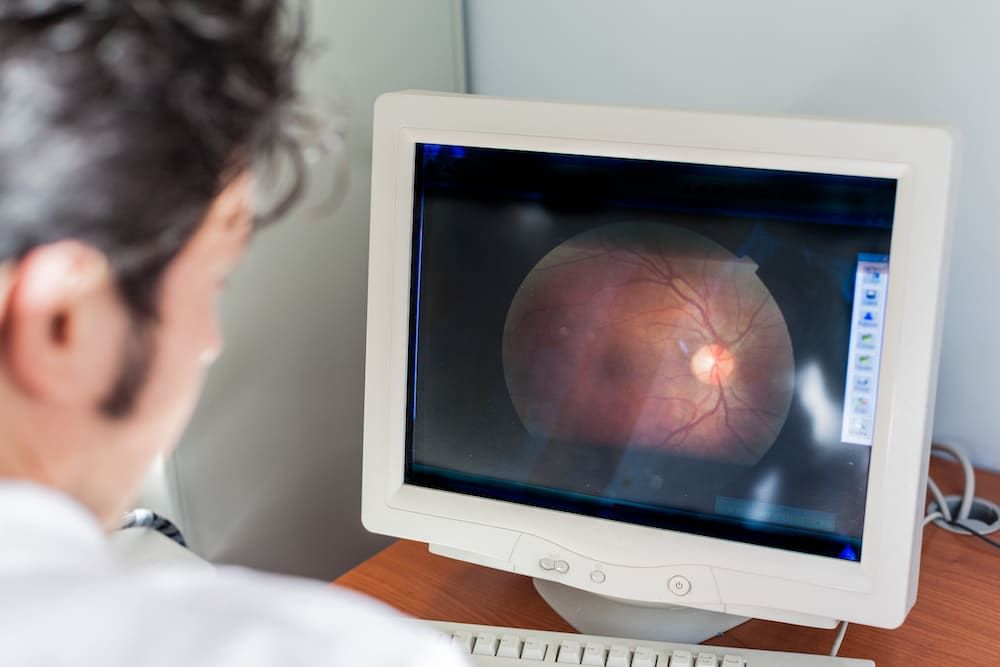 Why Is Retinal Imaging Necessary?