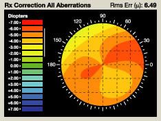 lasik imaging