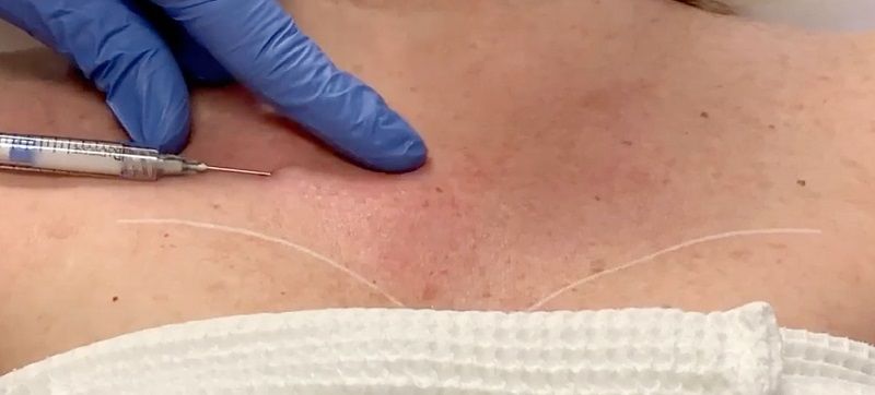 Pages / Decolette - Cleavage Chest Wrinkles