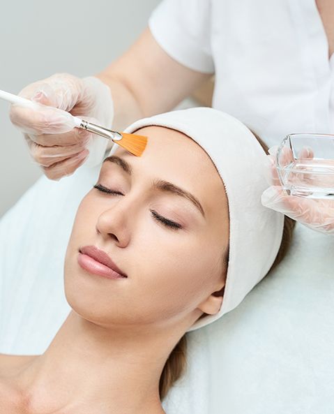 Chemical Peel