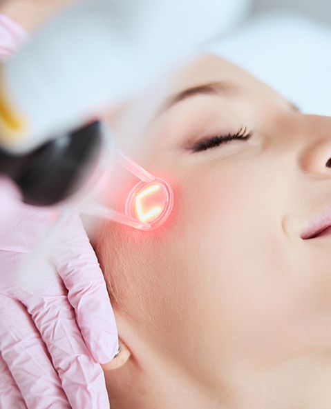 Laser Resurfacing