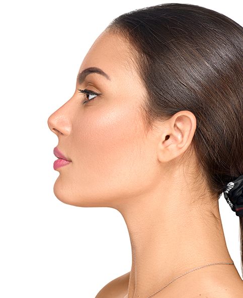 Nose Job