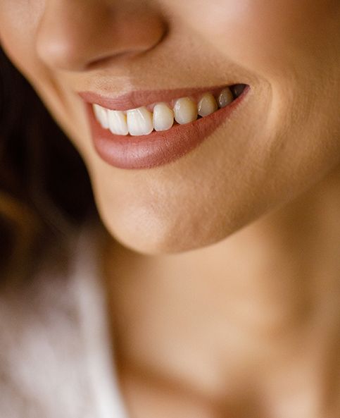 Non-Surgical Smile Lift 