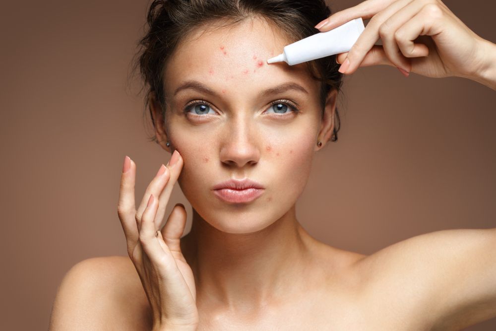 Does Corticosteroid Injection Treat Acne?
