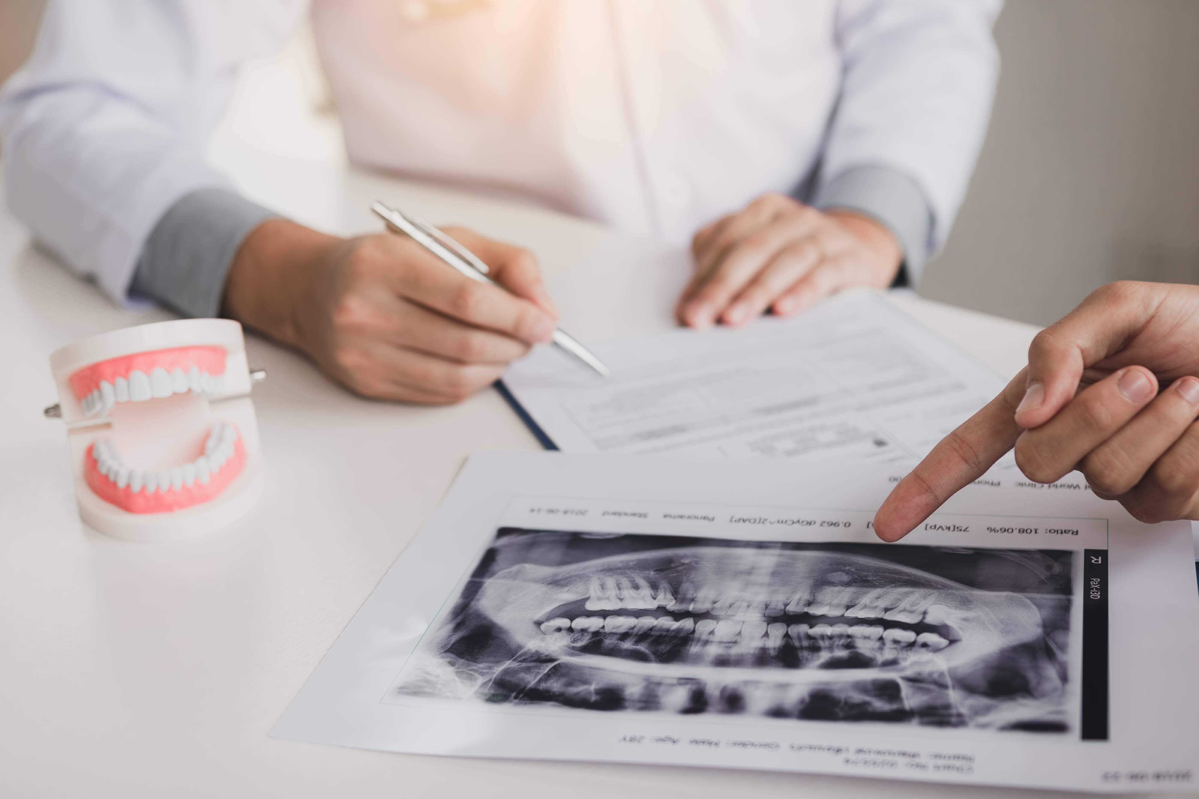 Why Annual Dental X-rays Are Important
