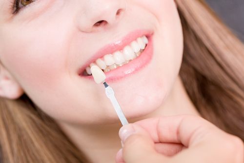 smile makeover
