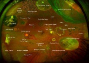 optomap imaging