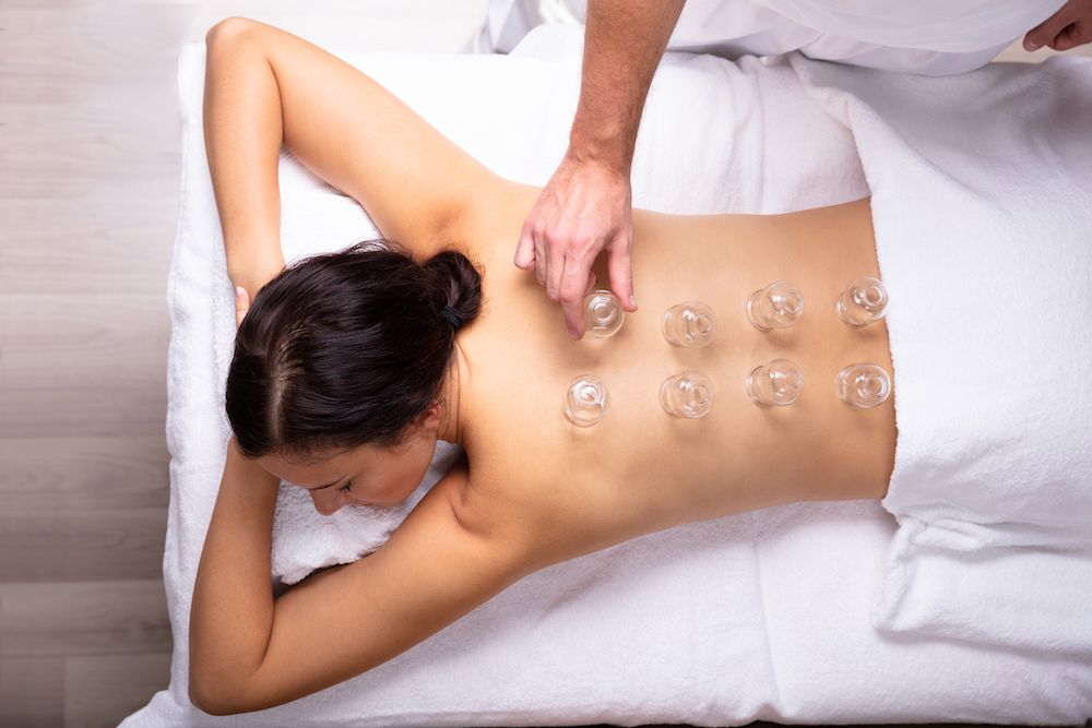 What is the Purpose of Cupping?
