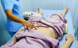 Your Guide to Electroacupuncture