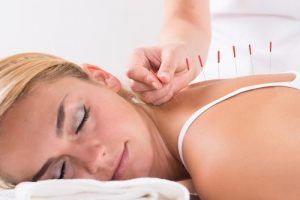 Acupuncture as a Modern Medical Practice