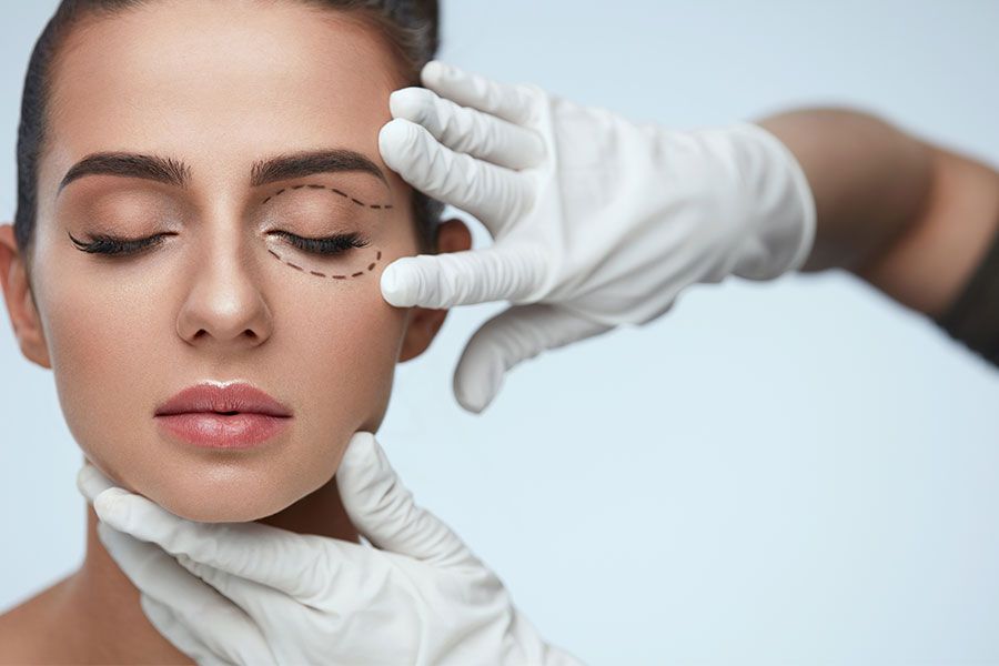 Blepharoplasty