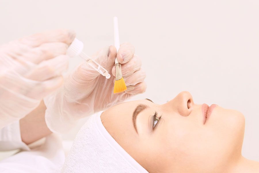 Chemical Peel