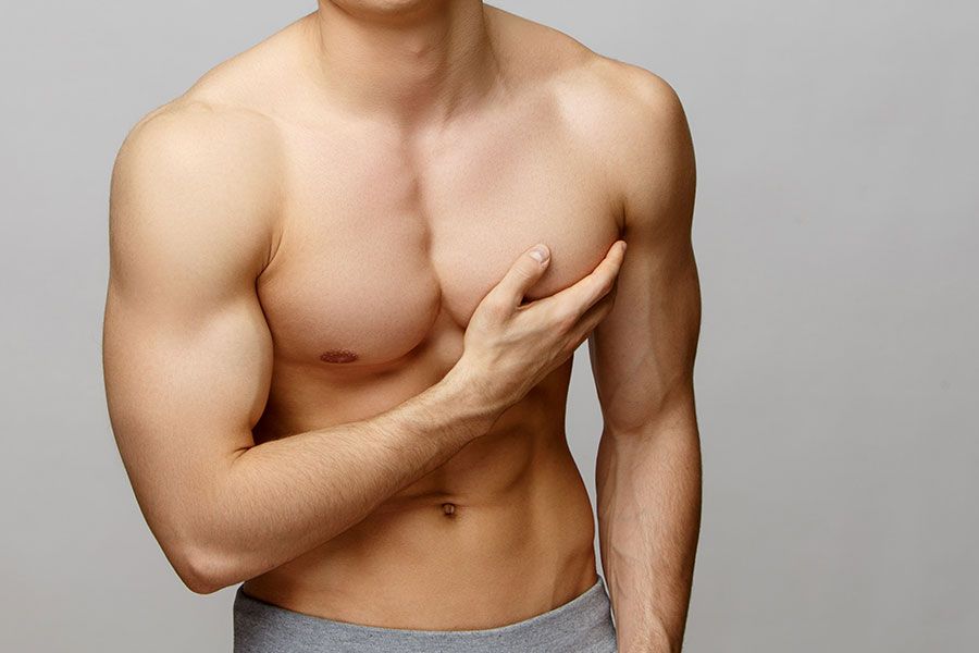 Gynecomastia