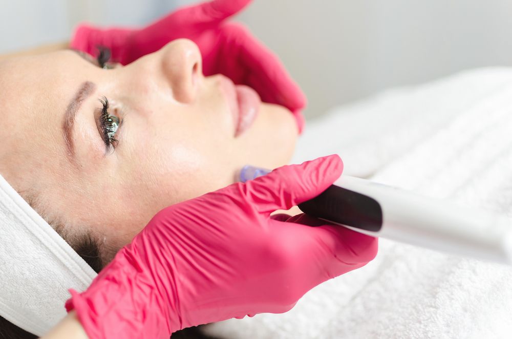 Do's and Don'ts After a Microneedling Treatment