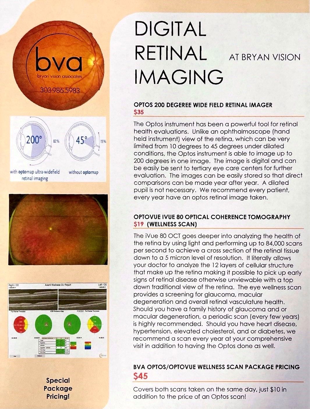 Retinal Imaging