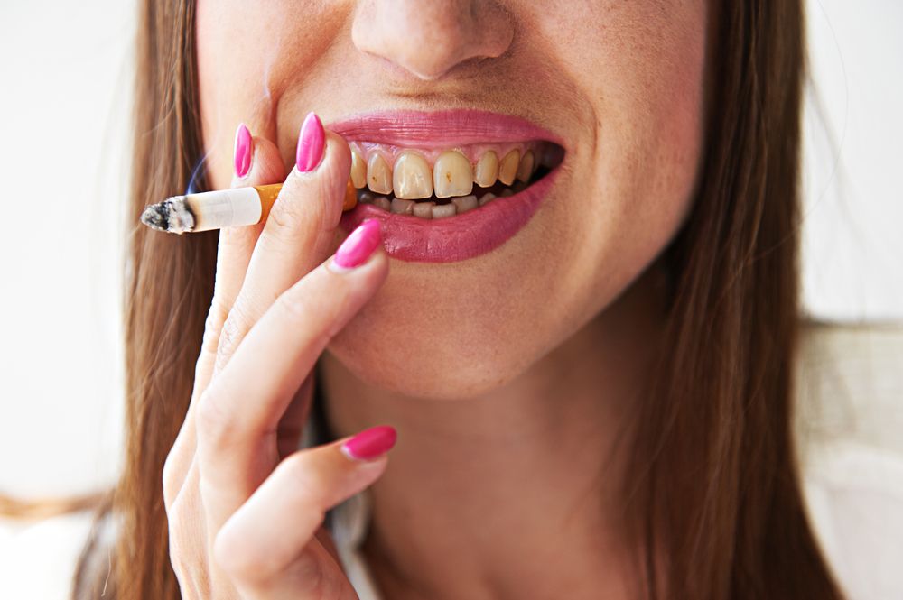 What Does Smoking Do to Your Teeth and Gums?