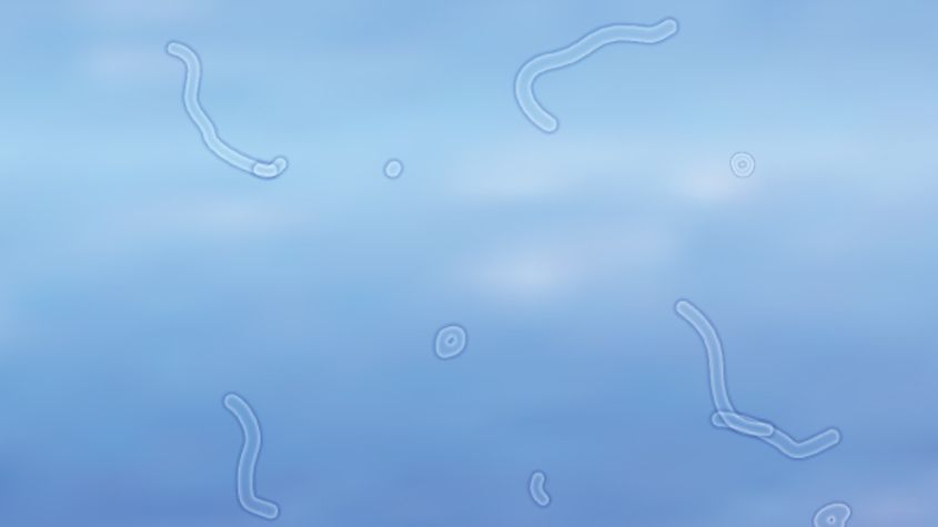 It’s a Bird, It’s a Plane, No….it’s just Floaters!