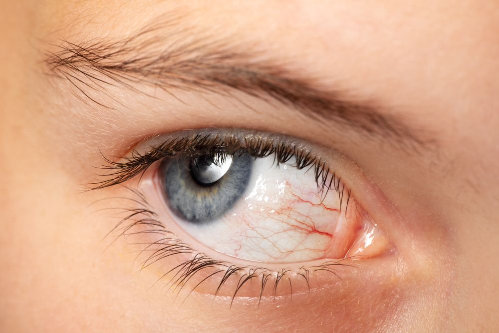 Understanding Common Ocular Diseases: Causes, Symptoms, and Treatments
