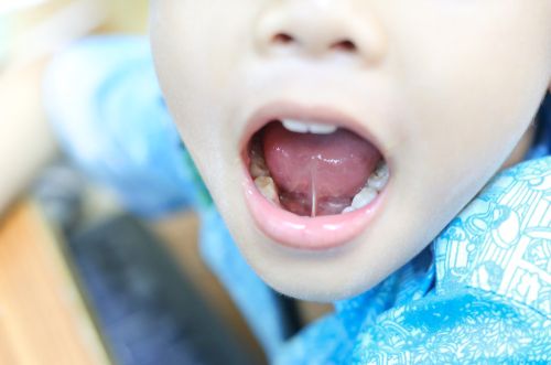 What Is Tongue-tie and How Can It Affect Your Child's Life?