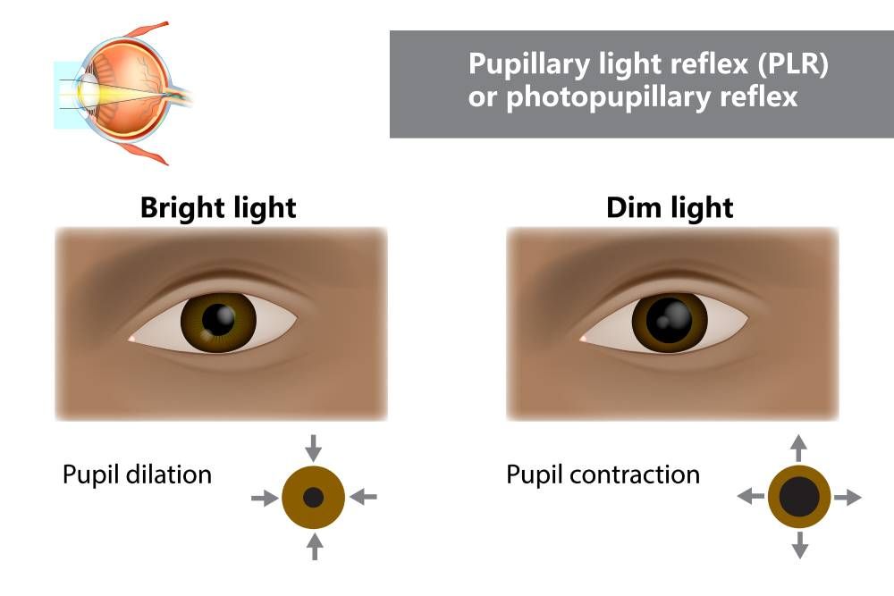 Dilated Fundus Exam