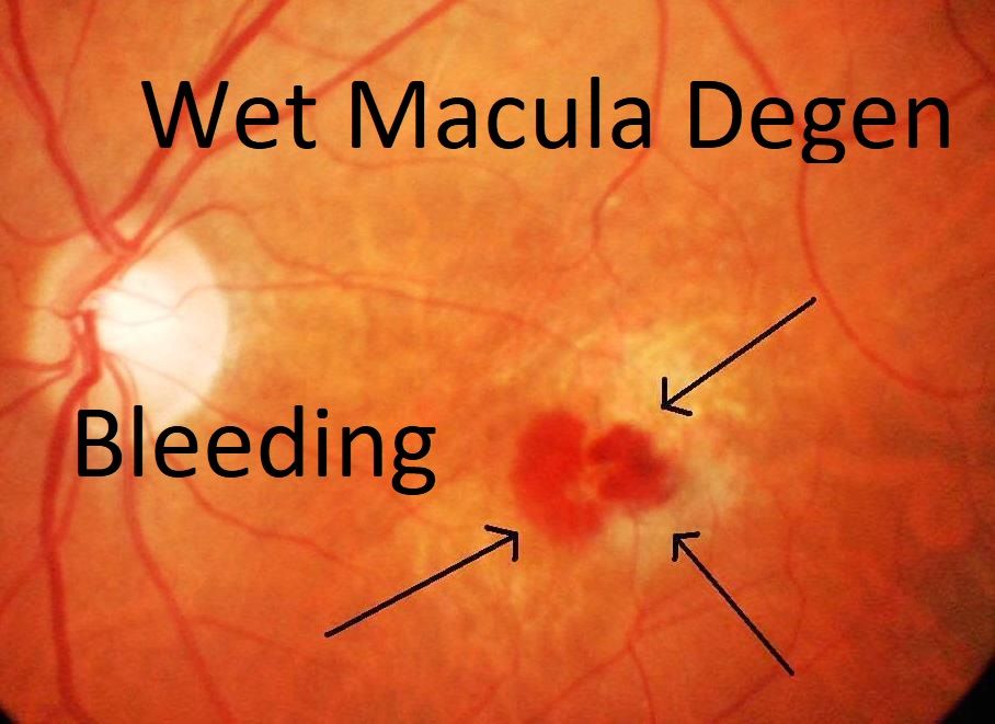 Eye Condition Diagnosis | Eye Doctors in Elmhurst, IL