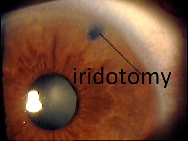 Treatment in Elmhurst, IL Skowron Eyecare