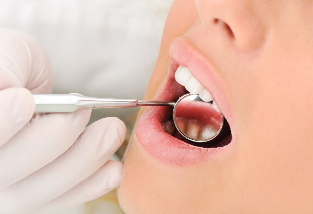 dental mirror