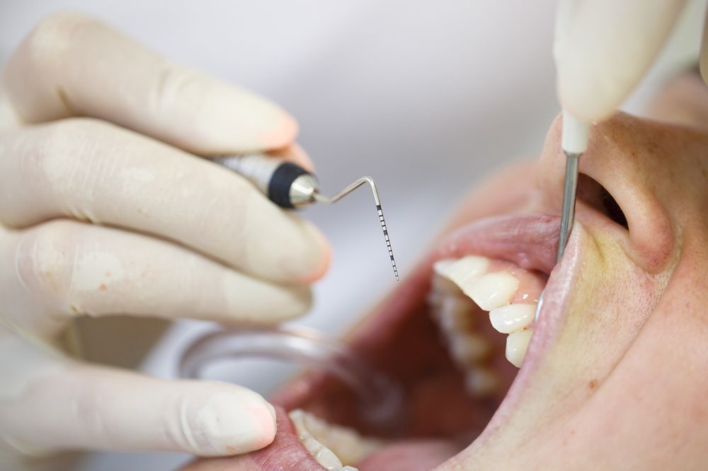 dental tool