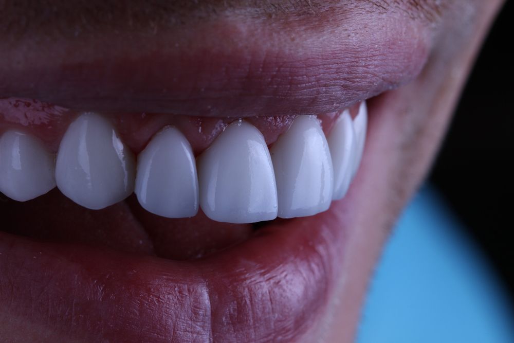 teeth
