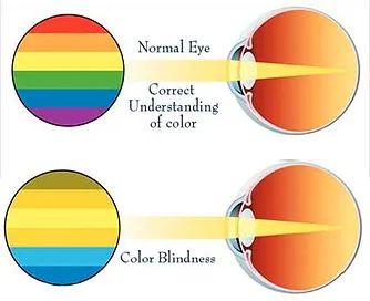 the eye with color blindness
