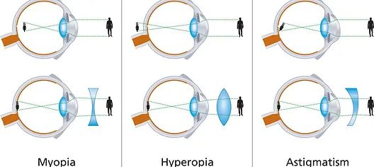 Understanding the Three Types of Eye Problems