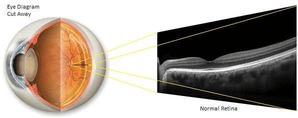 close up of eye retina