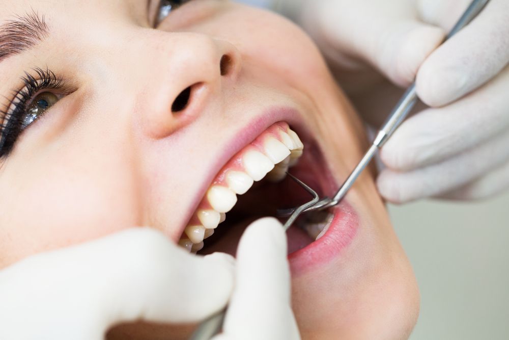 Dental Filling Procedure​​​​​​​