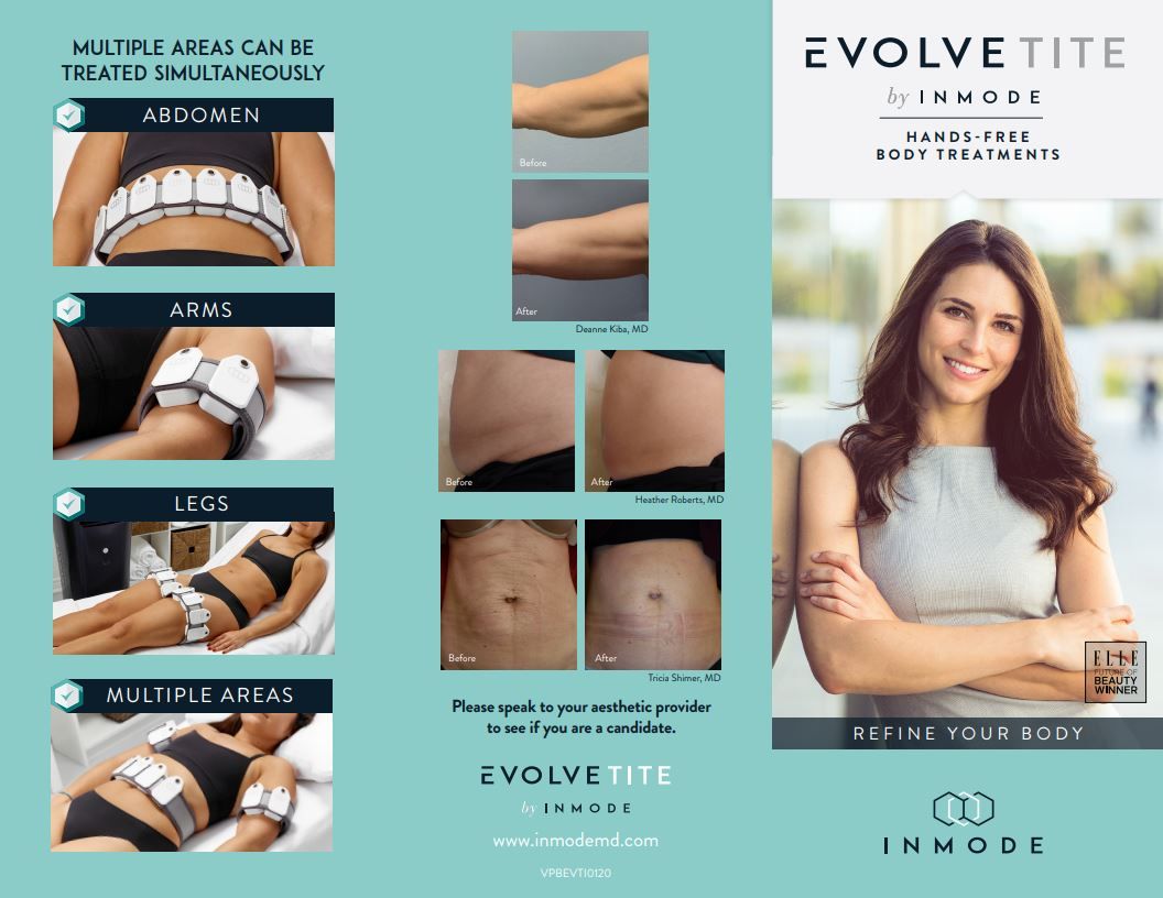 EVOLVE