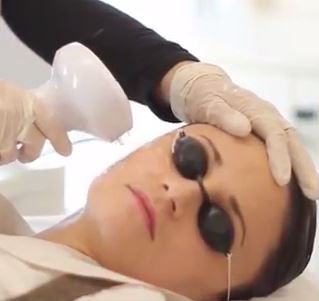 Woman under Lumecca IPL Laser Skin Rejuvenation