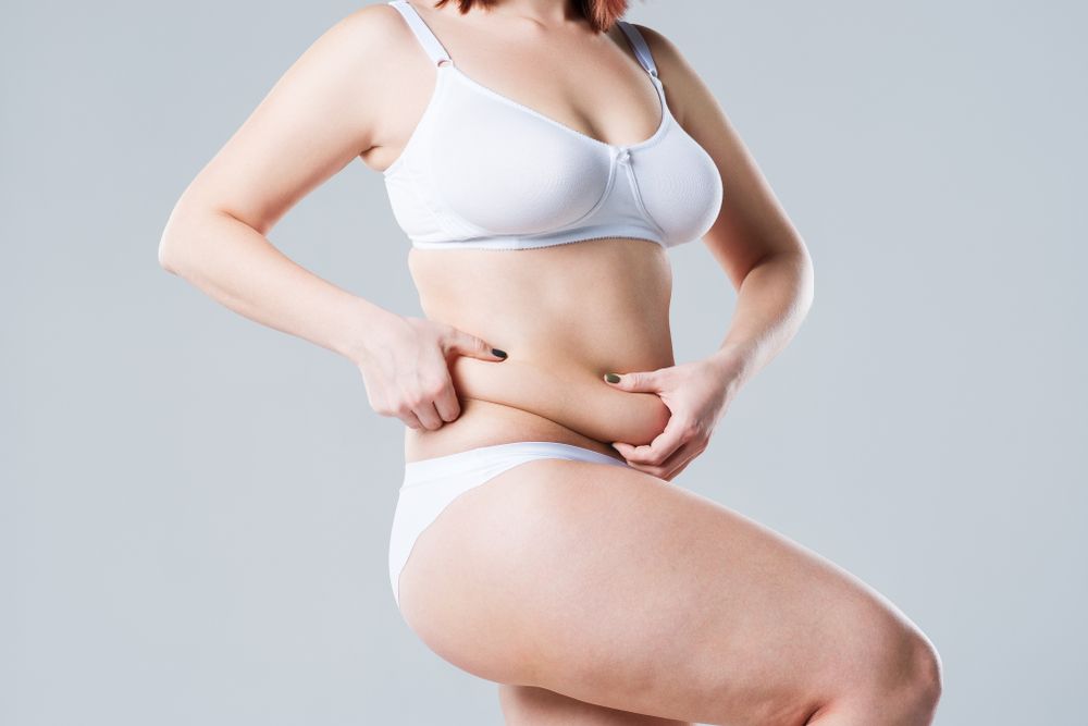 San Diego Tummy Tuck