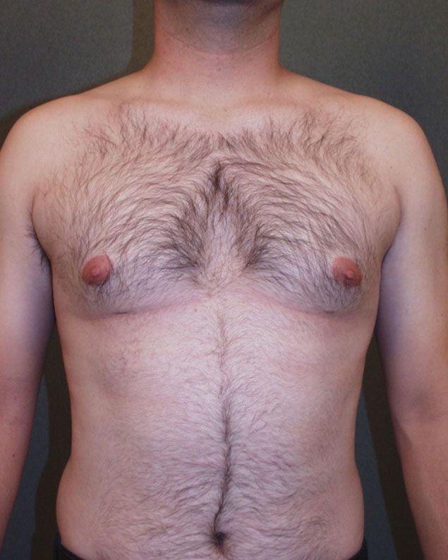 before and after