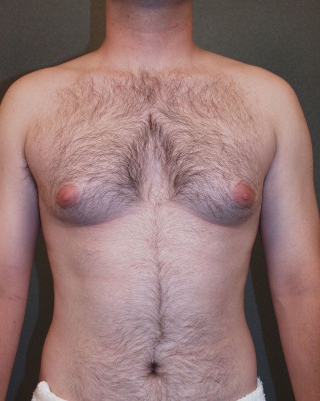 before and after