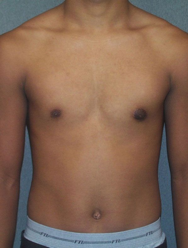 before and after
