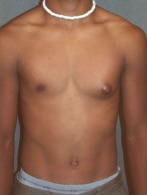 before and after