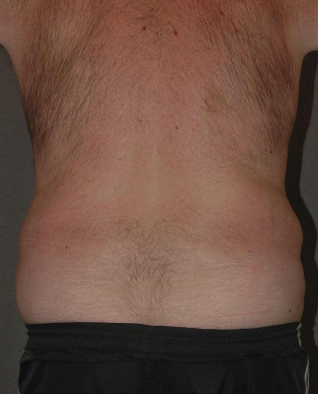 before and after